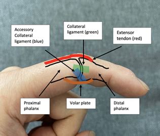 Sports Medicine Section // The Jammed Finger