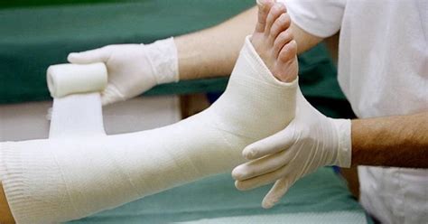 Cast Care - Dos and Don’ts of Taking Care of Casts | Women’s Choice Award